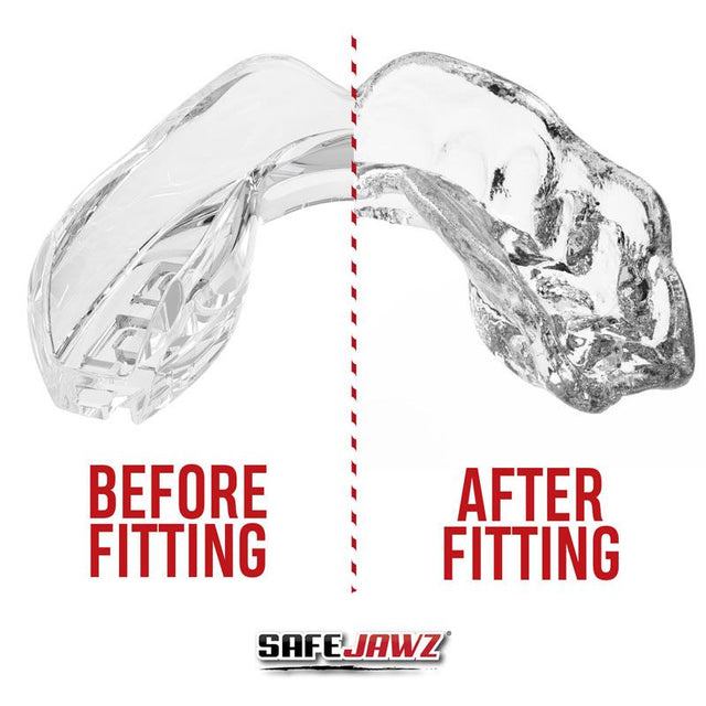 Safejawz Mouthguard Intro Series – Clear – Mouthguards