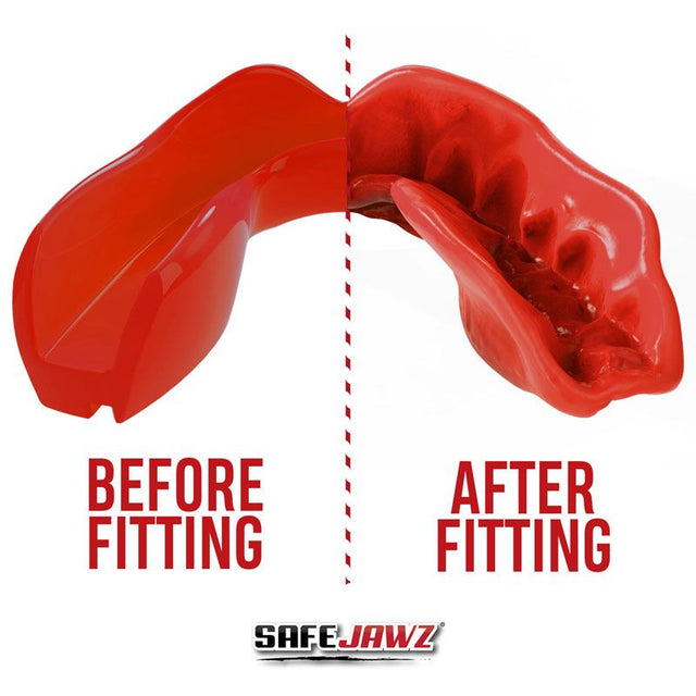 Safejawz Mouthguard Intro Series – Red