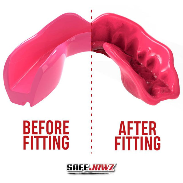Safejawz Mouthguard Intro Series – Pink – Mouthguards